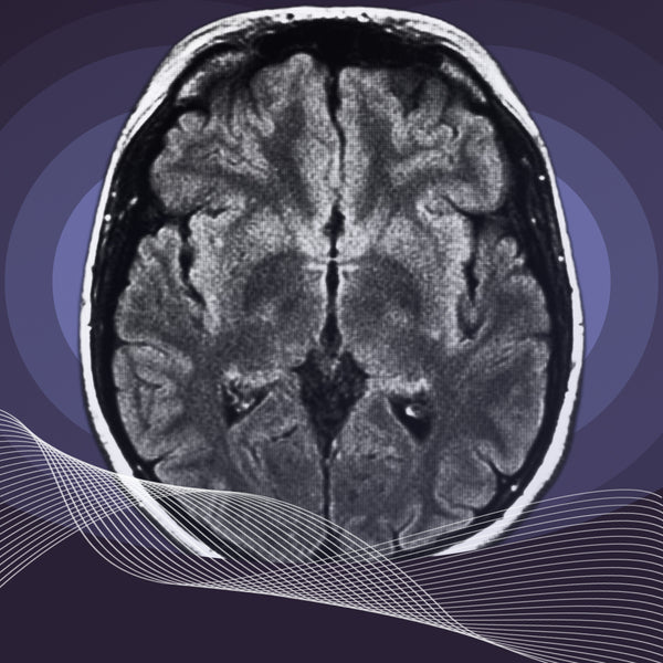 White matter in the brain: The key to synchrony