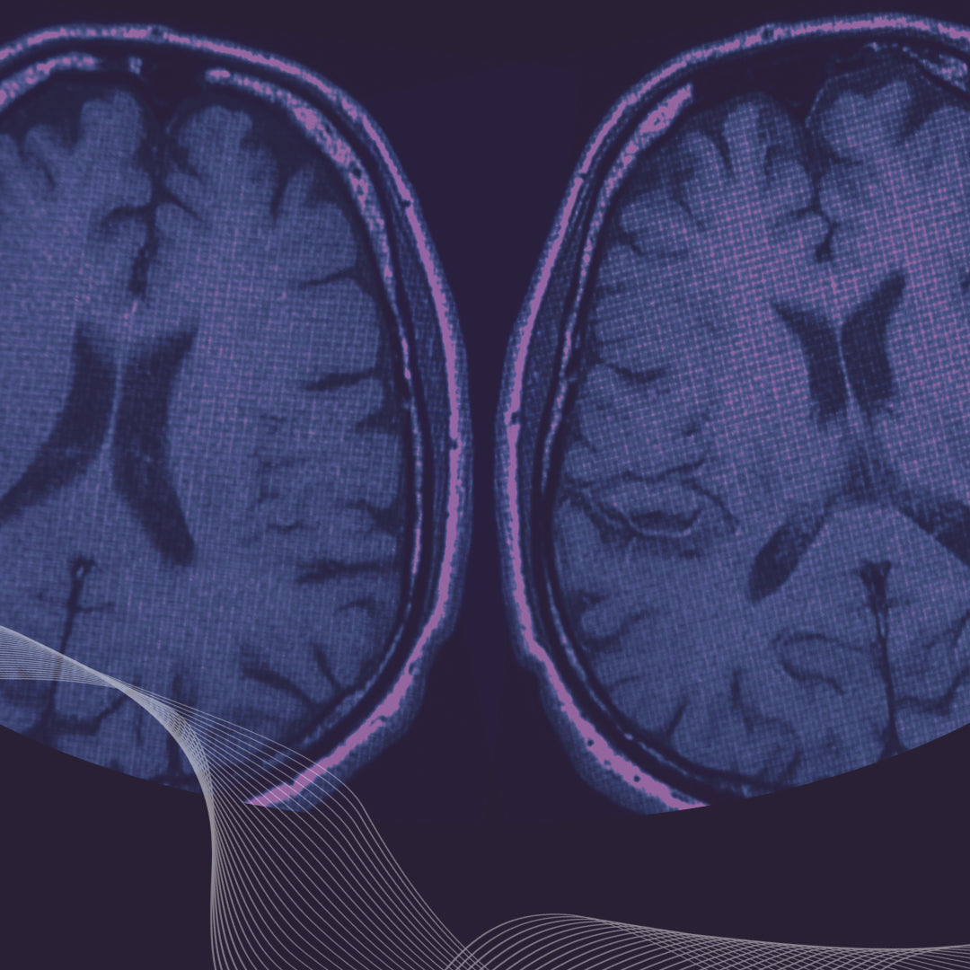 Two stylized axial brain scans mirrored on a dark background with purple and blue tones and a flowing white waveform overlay