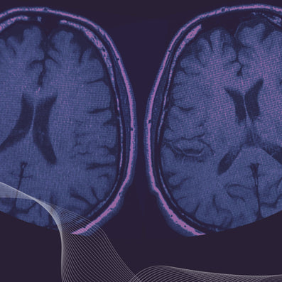 Predicting your brain age with portable EEG and machine learning